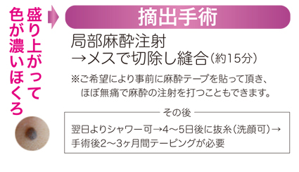 ほくろ除去 一部保険対応可 横浜市の美容皮膚科 美容外科 サロンエムズ 松井クリニック